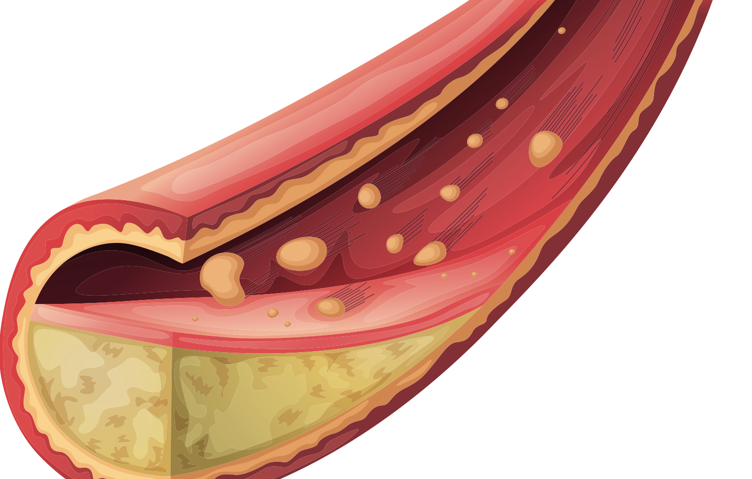 cholesterol