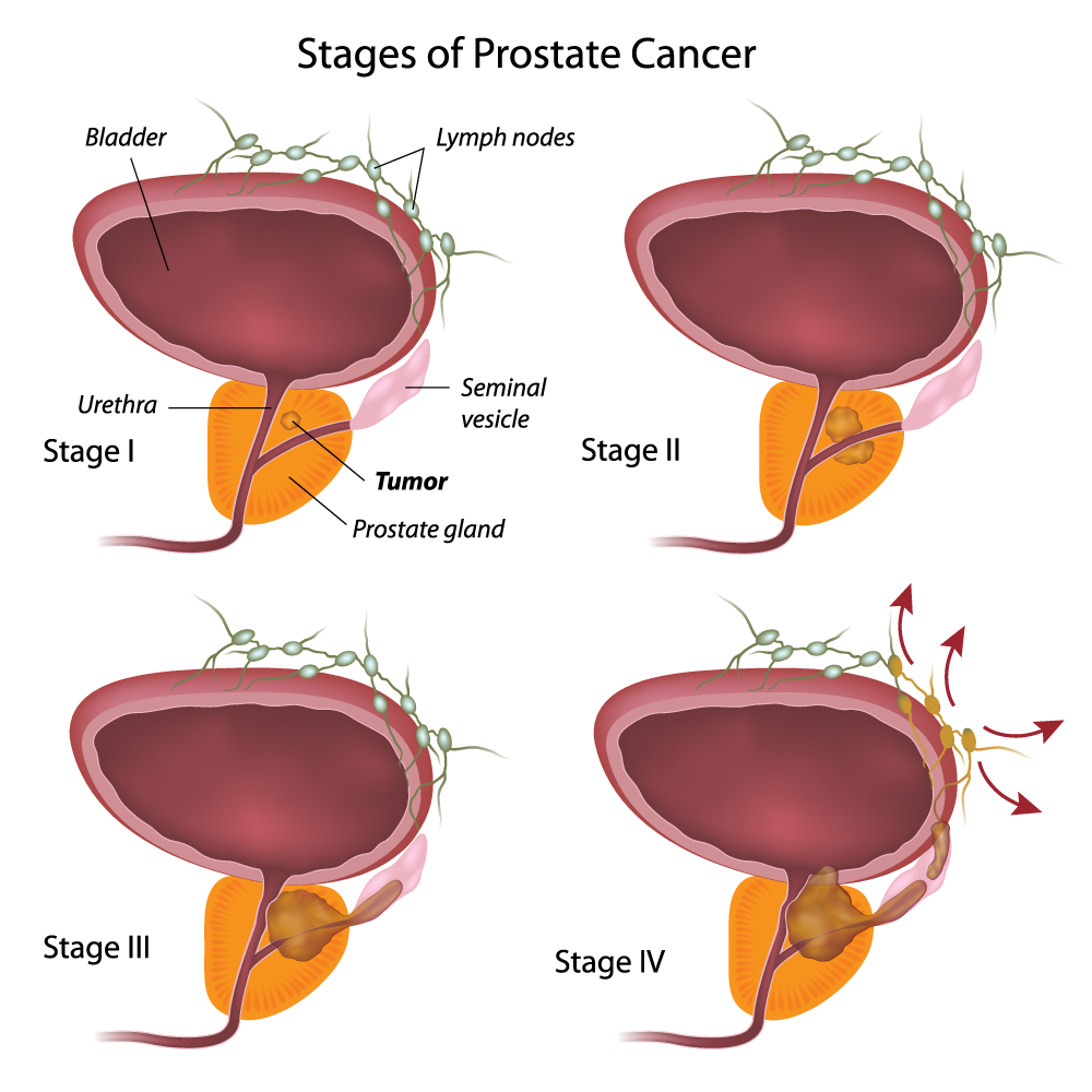 the-9-best-foods-you-can-eat-for-a-healthy-prostate-the-hearty-soul